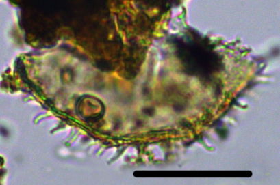 Eocladopyxis peniculatum 27X11391412401005b.jpg